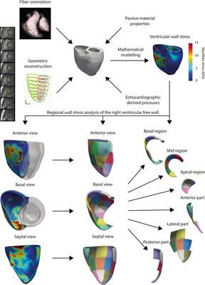 Serial RV wall stress measurements: association with right ventricular function in repaired Tetralogy of Fallot patients